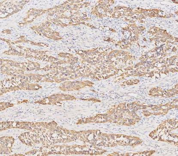 Cytokeratin 19/KRT19 Rabbit Polyclonal Antibody