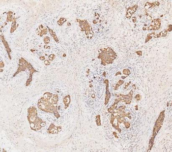 Cytokeratin 19/KRT19 Rabbit Polyclonal Antibody