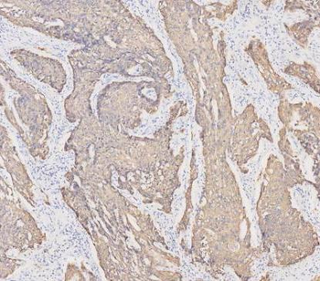Cytokeratin 19/KRT19 Rabbit Polyclonal Antibody