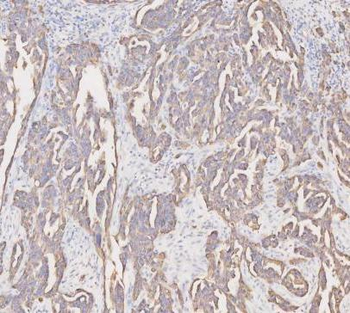 Cytokeratin 19/KRT19 Rabbit Polyclonal Antibody
