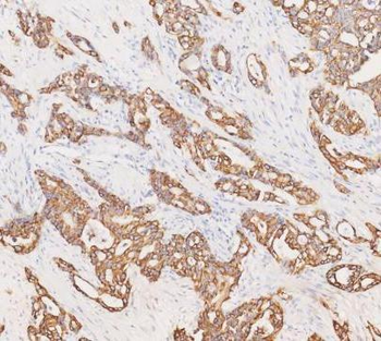 Cytokeratin 19/KRT19 Rabbit Polyclonal Antibody