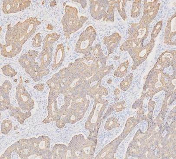 Cytokeratin 19/KRT19 Rabbit Polyclonal Antibody