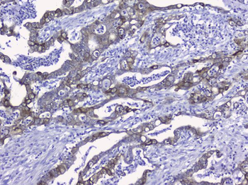Cytokeratin 19/KRT19 Rabbit Polyclonal Antibody
