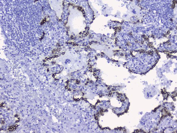 Cytokeratin 19/KRT19 Rabbit Polyclonal Antibody