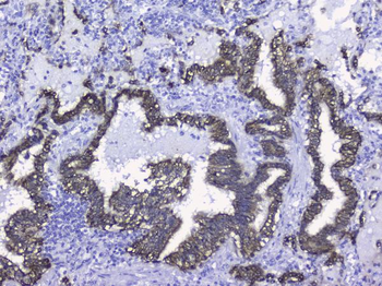 Cytokeratin 19/KRT19 Rabbit Polyclonal Antibody