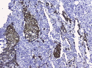 Cytokeratin 19/KRT19 Rabbit Polyclonal Antibody