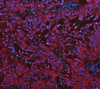 Cytokeratin 19/KRT19 Rabbit Polyclonal Antibody