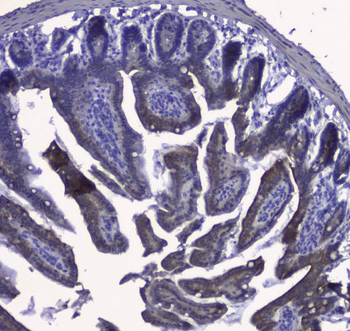 Cytokeratin 19/KRT19 Rabbit Polyclonal Antibody