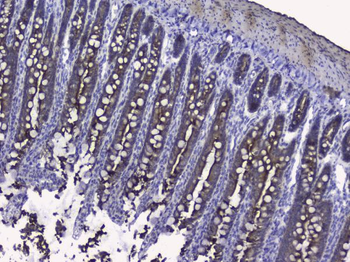 Cytokeratin 19/KRT19 Rabbit Polyclonal Antibody