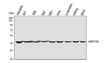 Cytokeratin 19/KRT19 Rabbit Polyclonal Antibody