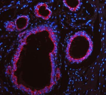 Cytokeratin 19/KRT19 Rabbit Polyclonal Antibody