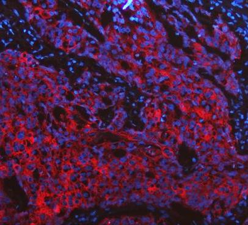 Cytokeratin 19/KRT19 Rabbit Polyclonal Antibody