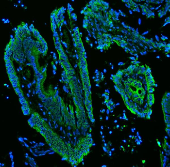 Cytokeratin 19/KRT19 Rabbit Polyclonal Antibody