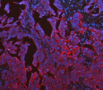 Cytokeratin 19/KRT19 Rabbit Polyclonal Antibody