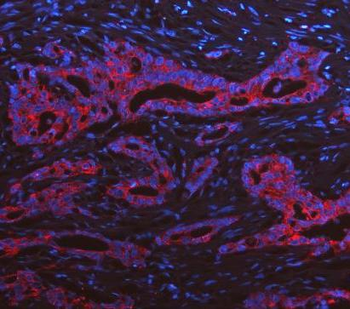 Cytokeratin 19/KRT19 Rabbit Polyclonal Antibody