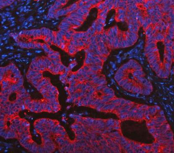 Cytokeratin 19/KRT19 Rabbit Polyclonal Antibody