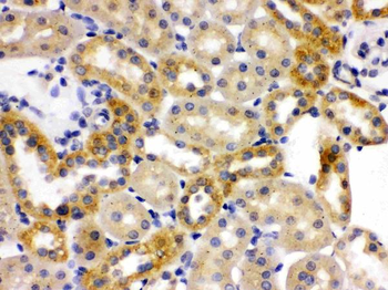 OPA1 Rabbit Polyclonal Antibody