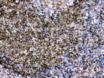 Pax2 Rabbit Polyclonal Antibody