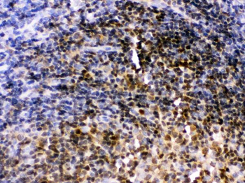 Pax2 Rabbit Polyclonal Antibody