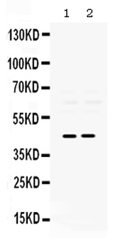 Pax2 Rabbit Polyclonal Antibody