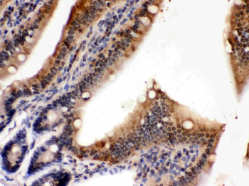 PDPK1 Rabbit Polyclonal Antibody