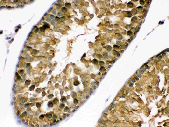 PDPK1 Rabbit Polyclonal Antibody