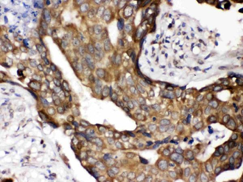 Cytochrome P450 Reductase/POR Rabbit Polyclonal Antibody
