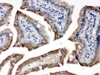 Cytochrome P450 Reductase/POR Rabbit Polyclonal Antibody