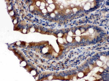 Cytochrome P450 Reductase/POR Rabbit Polyclonal Antibody
