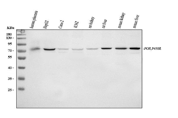 Cytochrome P450 Reductase/POR Rabbit Polyclonal Antibody
