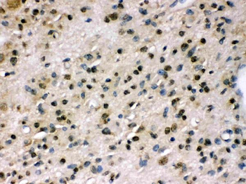 Myosin Phosphatase/PPP1R12A Rabbit Polyclonal Antibody