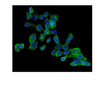 AMPK beta 2/PRKAB2 Rabbit Polyclonal Antibody