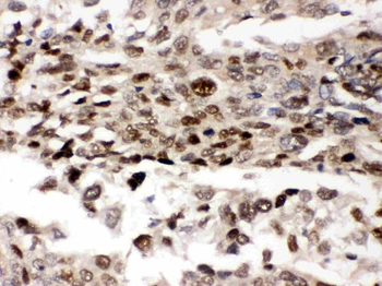 AMPK beta 2/PRKAB2 Rabbit Polyclonal Antibody