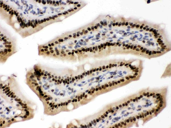 AMPK beta 2/PRKAB2 Rabbit Polyclonal Antibody