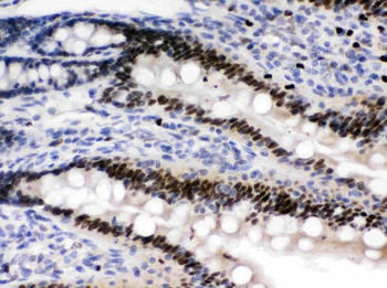 AMPK beta 2/PRKAB2 Rabbit Polyclonal Antibody