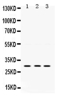AMPK beta 2/PRKAB2 Rabbit Polyclonal Antibody