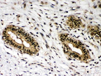 c-Rel Rabbit Polyclonal Antibody