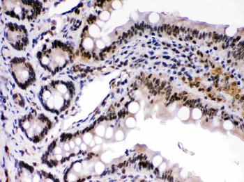 c-Rel Rabbit Polyclonal Antibody