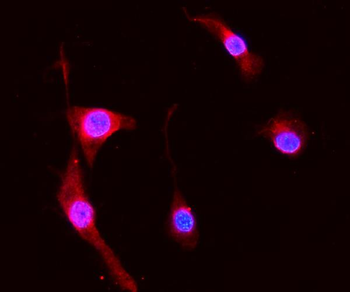 MRP8/S100A8 Rabbit Polyclonal Antibody