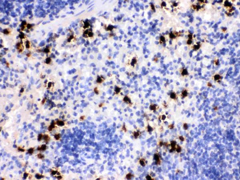 MRP8/S100A8 Rabbit Polyclonal Antibody