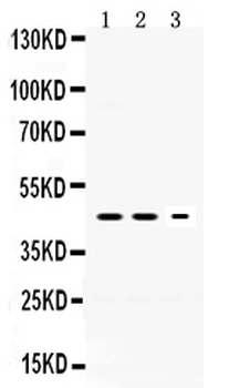 Neuroserpin/SERPINI1 Rabbit Polyclonal Antibody