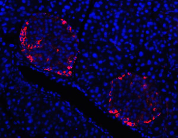 Prealbumin/TTR Rabbit Polyclonal Antibody