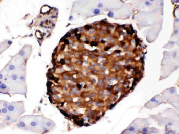 Prealbumin/TTR Rabbit Polyclonal Antibody