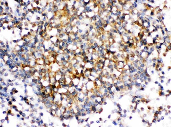 CD153/TNFSF8 Rabbit Polyclonal Antibody