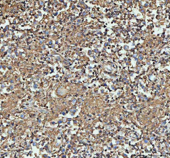 Actin/ACTA1 Rabbit Polyclonal Antibody