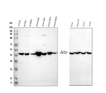 Actin/ACTA1 Rabbit Polyclonal Antibody
