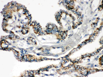 Bik Rabbit Polyclonal Antibody