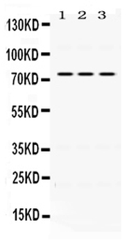 IL2 Receptor beta/IL2RB Rabbit Polyclonal Antibody