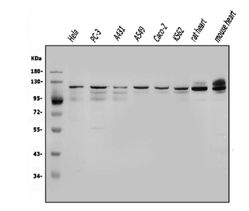 OGT/O-Linked N-Acetylglucosamine Transferase Rabbit Polyclonal Antibody