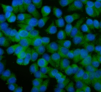 ALIX/PDCD6IP Rabbit Polyclonal Antibody